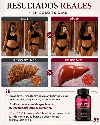Aurea Prestige - Tu Aliado para el higado graso. Deshinchate y Recupera tu Energía Vital